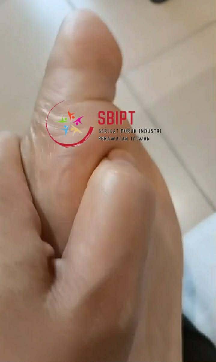 Kakiku Terkilir dan Majikanku Hanya Membawaku Berobat ke Fisioterapi